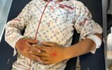پایان دردناک آتش سوزی چمگل